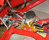 �A�N�Z�������[�X